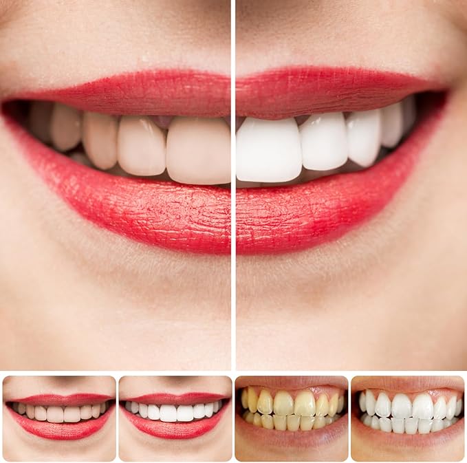 Purple Teeth Whitening Toothpaste